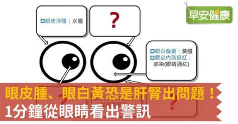 眼睛周圍黃黃的|眼皮腫、眼白黃恐是肝腎出問題！從眼睛看出6大警訊